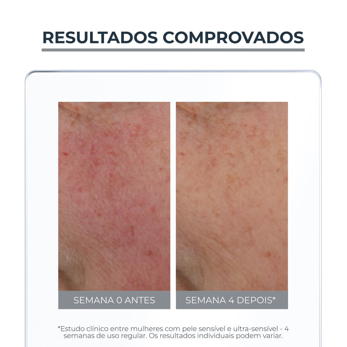 Eucerin Anti Redness Fluido Neutralizante FPS 30 50ml – pele sensível